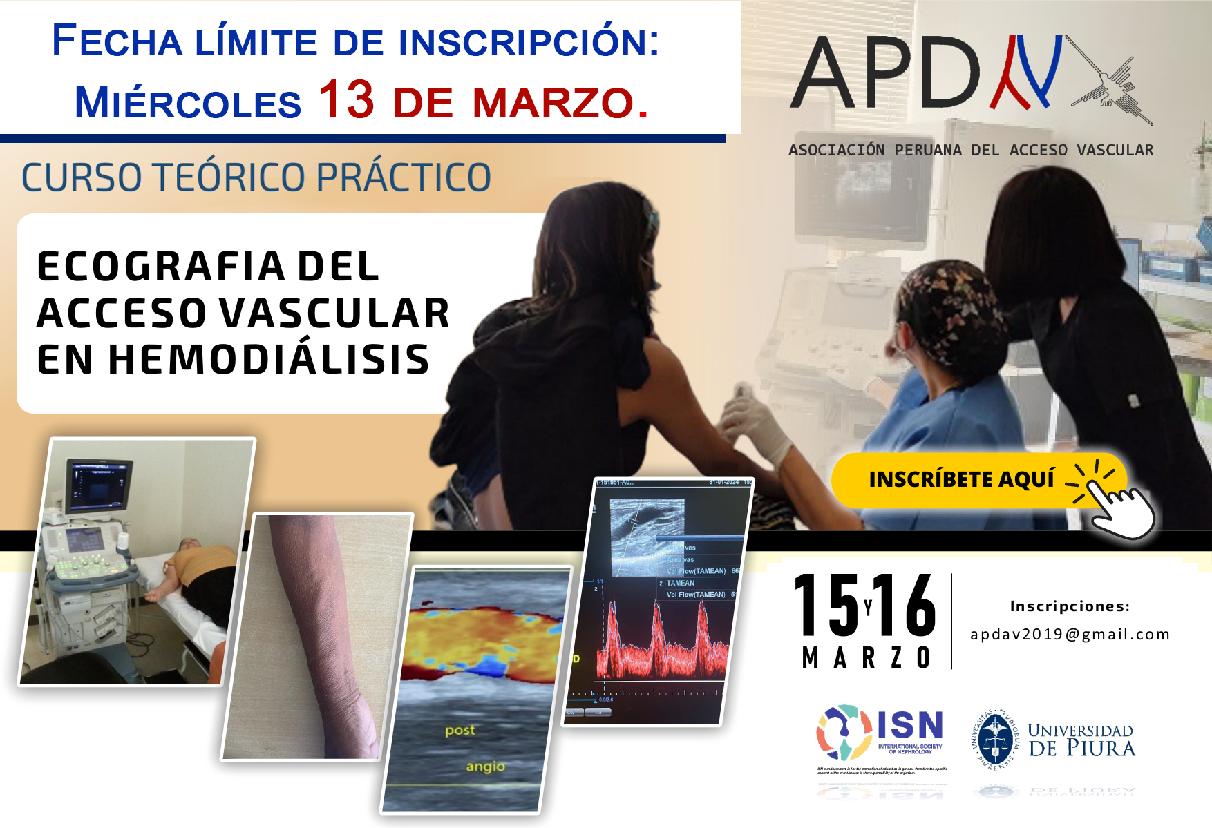 Read more about the article Curso Teórico Práctico – Ecografia del Acceso Vascular En Hemodiálisis