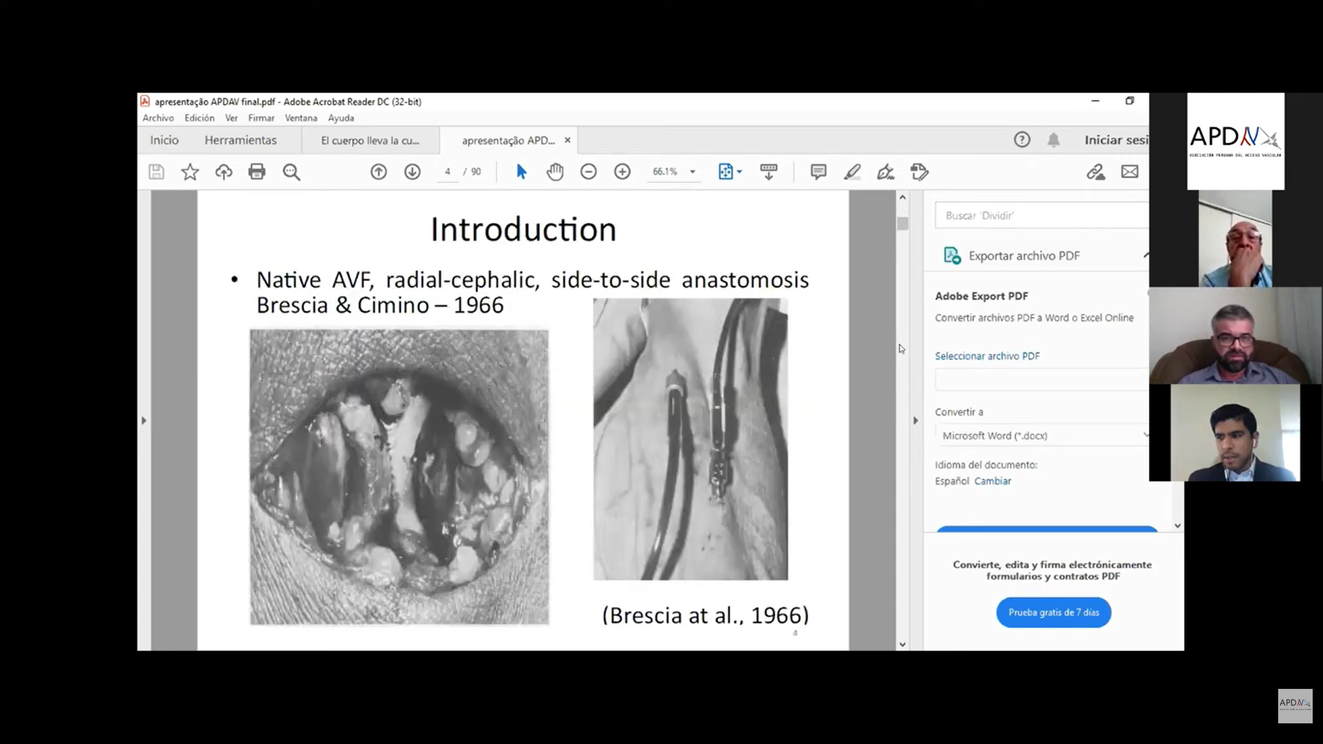 Read more about the article Dr Tavares – Experiencia y procedimientos para la creación de fístula arterio venosa por Nefrología