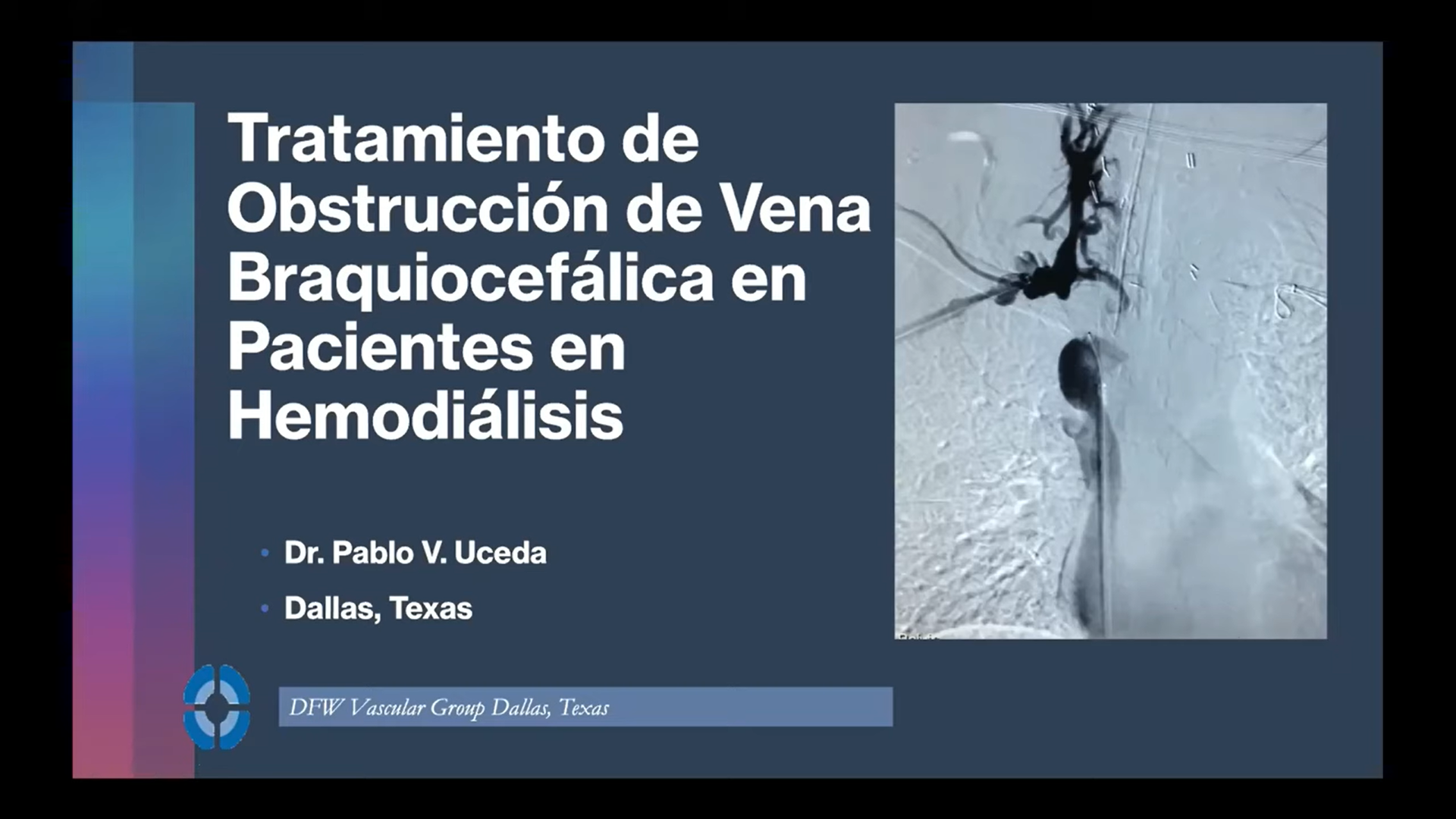 Read more about the article Dr. Uceda – Manejo quirúrgico y revisión de casos de pacientes con oclusión braquiocefálica